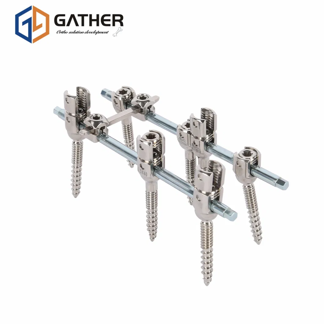 Factory Price Orthopedic Spinal Fixation Internal Implant Pedicle Screw Titanium Mesh